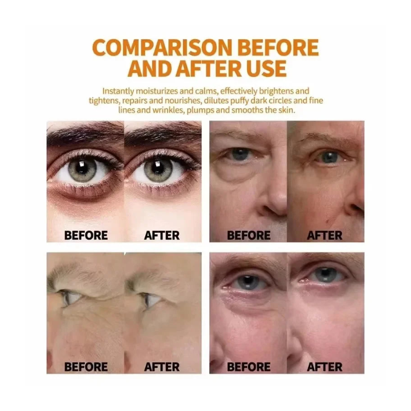 Suero de ojos con retinol antiojeras y bolsas