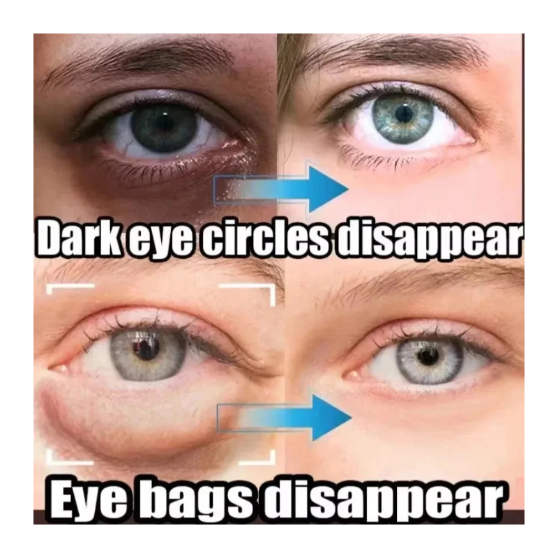 Suero de ojos con retinol antiojeras y bolsas